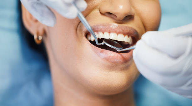 Best Emergency Dentist for Lost Fillings or Crowns in East Troy, WI